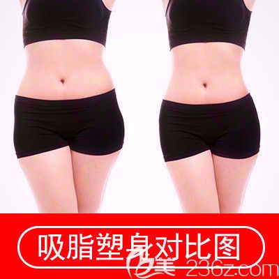 維多利亞吸脂整形案例 維多利亞吸脂整形案例