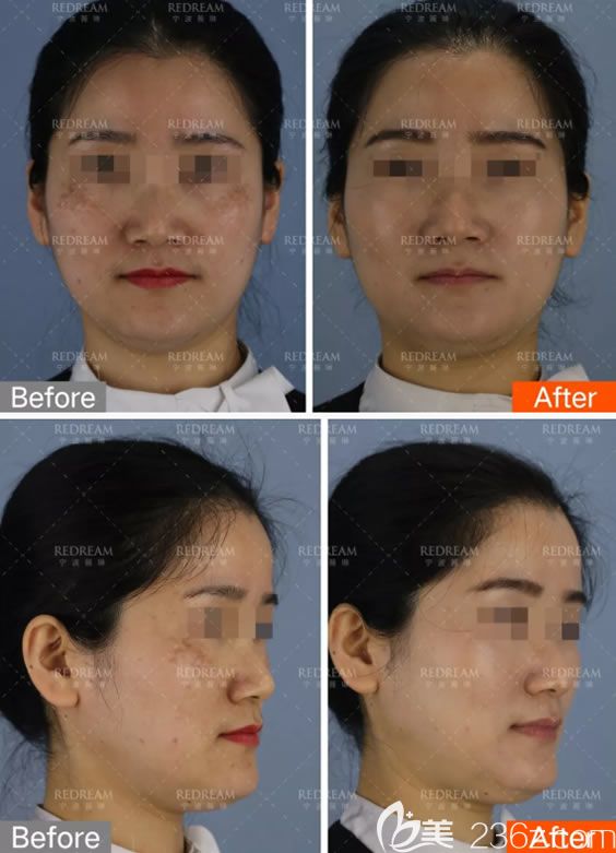 寧波薇琳ME美白祛斑<span style= 寧波薇琳ME美白祛斑<span style=