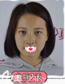 韓偉強(qiáng)院長(zhǎng)做<span style= 韓偉強(qiáng)院長(zhǎng)做<span style=