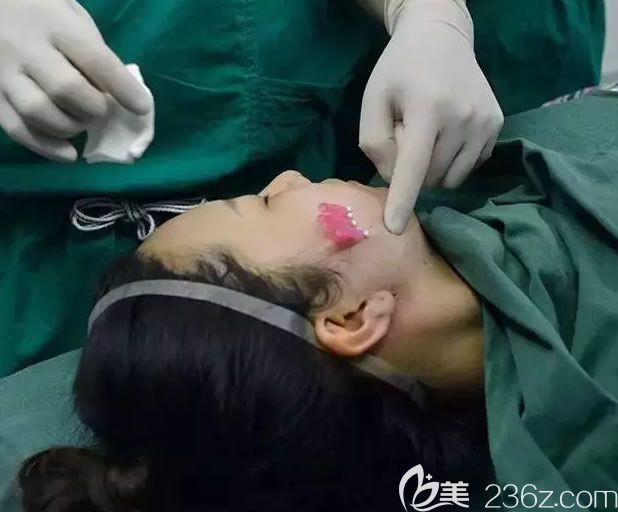 南寧美麗焦點(diǎn)醫(yī)生在給我做埋線手術(shù)中 南寧美麗焦點(diǎn)醫(yī)生在給我做埋線手術(shù)中