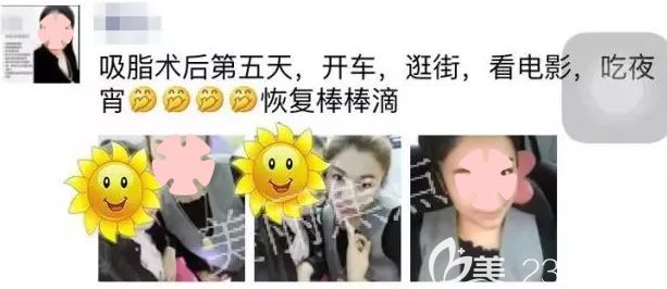 我在南寧美麗焦點(diǎn)做水動(dòng)力腰腹吸脂第5天恢復(fù)情況