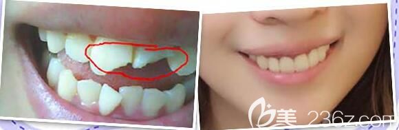 重慶牙博士口腔陳澤旭怎么樣？案例效果驗證醫(yī)生實力