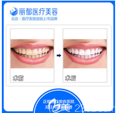 北京米蘭柏羽麗都遇海波醫(yī)生超聲波洗牙