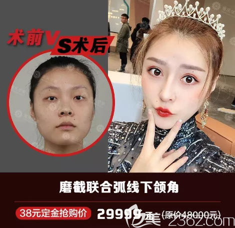 重慶華美磨骨技術怎么樣