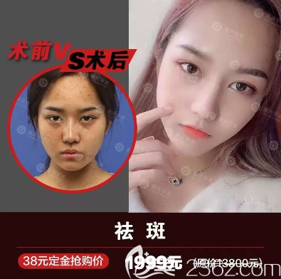 重慶華美祛斑怎么樣？