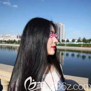 北京沃爾醫(yī)療美容診所鼻修復<span style=