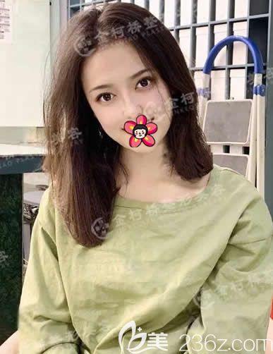 一個月前在醫(yī)院做了全切雙眼皮,把割雙眼皮后預(yù)防疤痕增生的方法寫給大家