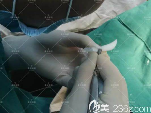 金華瑞麗劉政假體隆鼻手術(shù)過(guò)程 金華瑞麗劉政假體隆鼻手術(shù)過(guò)程