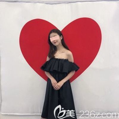 假體隆下巴第1個月