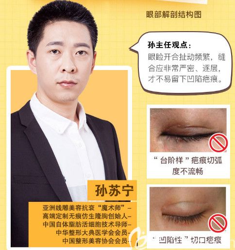 天宏整形醫(yī)生孫蘇寧對雙眼皮手術(shù)的觀點 天宏整形醫(yī)生孫蘇寧對雙眼皮手術(shù)的觀點