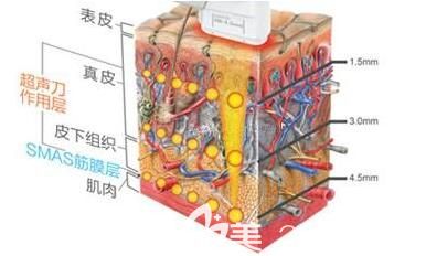 上海麗質(zhì)醫(yī)療美容門診部胡彩艷工作原理 上海麗質(zhì)醫(yī)療美容門診部胡彩艷工作原理