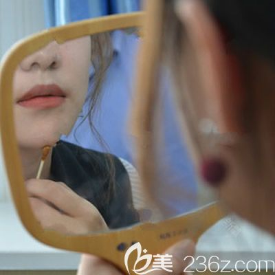 西寧康華<!--<i data=20240703-sp></i>-->院長(zhǎng)為我注射隆下巴術(shù)后當(dāng)天照 西寧康華<!--<i data=20240703-sp></i>-->院長(zhǎng)為我注射隆下巴術(shù)后當(dāng)天照