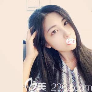 洛陽華美自體脂肪填充術(shù)后15天