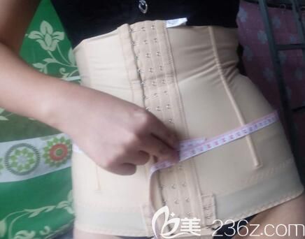 我在桂林美麗焦點做腰腹部環(huán)吸術(shù)后第7天 我在桂林美麗焦點做腰腹部環(huán)吸術(shù)后第7天