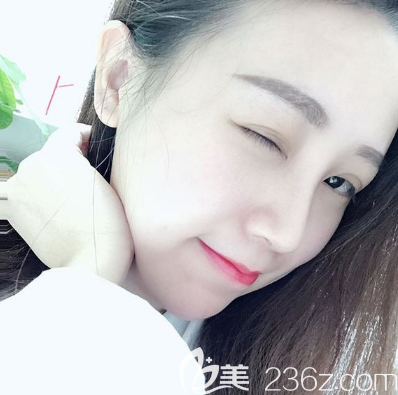 佛山曙光金子內部員工用親身經(jīng)歷告訴你宋仁剛博士做肋軟骨隆鼻子效果怎么樣