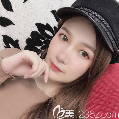 佛山曙光金子李淑薇做雙眼皮怎么樣 佛山曙光金子李淑薇做雙眼皮怎么樣