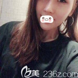 我的鼻綜合手術(shù)日記-看洛陽(yáng)愛(ài)尚李進(jìn)雯幫我打造的高翹立挺小美鼻 