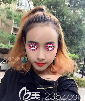 北京沃爾醫(yī)療美容肋軟骨鼻綜合<span style= 北京沃爾醫(yī)療美容肋軟骨鼻綜合<span style=