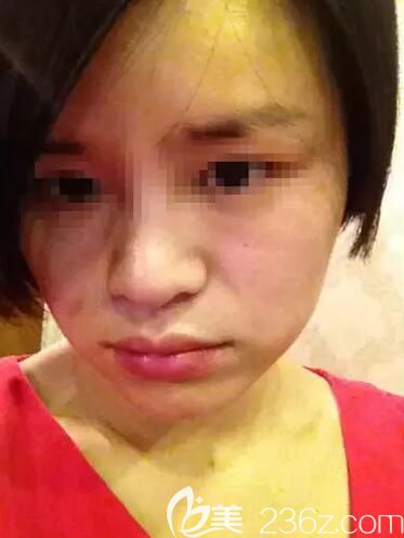 面診常熟時(shí)代術(shù)前膚色暗沉 面診常熟時(shí)代術(shù)前膚色暗沉