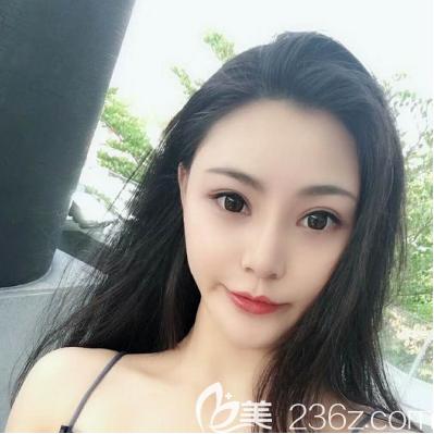 剛?cè)ド钲邴惛埯惛褡鐾瓯亲拥奈襾砀嬖V你謝俊院長隆鼻技術(shù)怎么樣