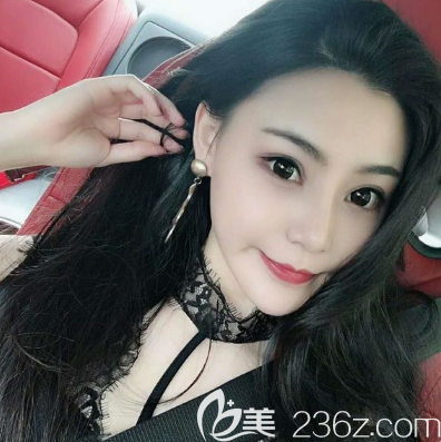 深圳麗港麗格謝俊隆鼻案例三個(gè)月反饋照片 深圳麗港麗格謝俊隆鼻案例三個(gè)月反饋照片