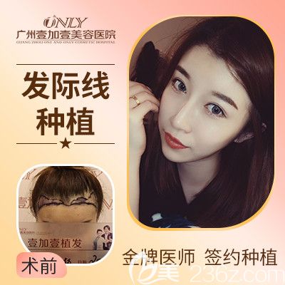 廣州壹加壹游鳳軍植發(fā)<span style=