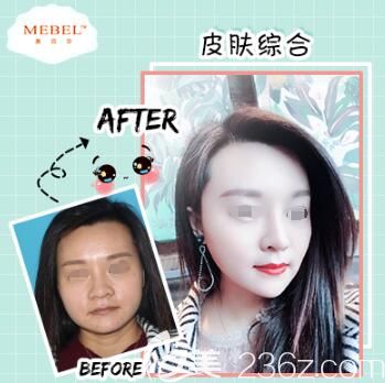 郭敏醫(yī)生祛斑美白案例 郭敏醫(yī)生祛斑美白案例