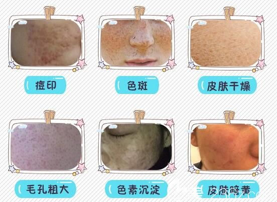 擅長(zhǎng)激光美膚的魏凌華醫(yī)生 擅長(zhǎng)激光美膚的魏凌華醫(yī)生