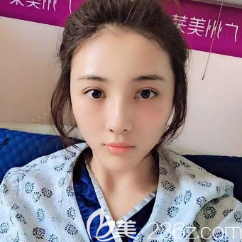 廣州美萊<!--<i data=20240703-sp></i>-->自體脂肪全臉填充