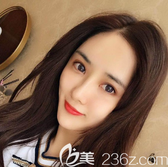 <!--<i data=20240703-sp></i>-->面部脂肪填充全臉一個月恢復(fù)自然