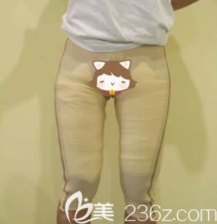 我在北海韓美做大腿水動力環(huán)形吸脂第5天