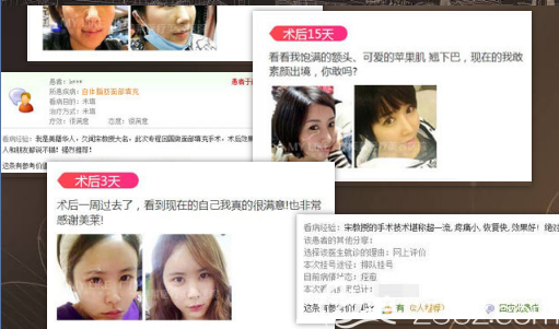 愛(ài)美者對(duì)<!--<i data=20240703-sp></i>-->做的脂肪填充術(shù)后真實(shí)評(píng)價(jià) 愛(ài)美者對(duì)<!--<i data=20240703-sp></i>-->做的脂肪填充術(shù)后真實(shí)評(píng)價(jià)