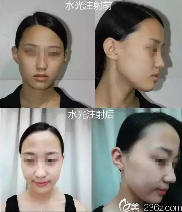 膚色不均、面色暗黃還在靠面膜?戳進(jìn)來(lái)看常州施爾美分享的詳細(xì)過程還有效果可對(duì)比