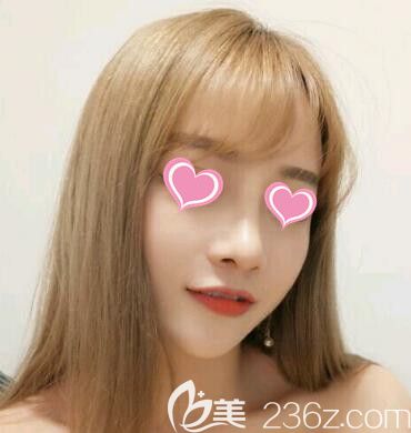 看了我在錦州斯美諾整形醫(yī)院做的肋軟骨+膨體鼻綜合效果后 小姐妹們說也要去做同款的！