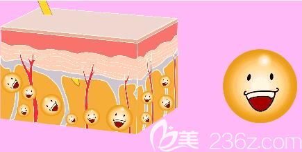 大腿吸脂手術(shù)