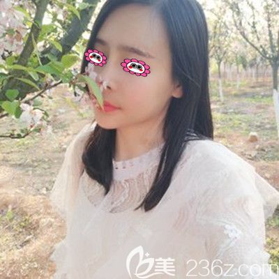 術(shù)后一個月效果展示圖 術(shù)后一個月效果展示圖