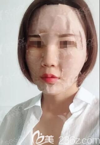 剛做完納米脂肪全面部<span style=