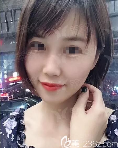 常州曙光分享納米脂肪全面部<span style=