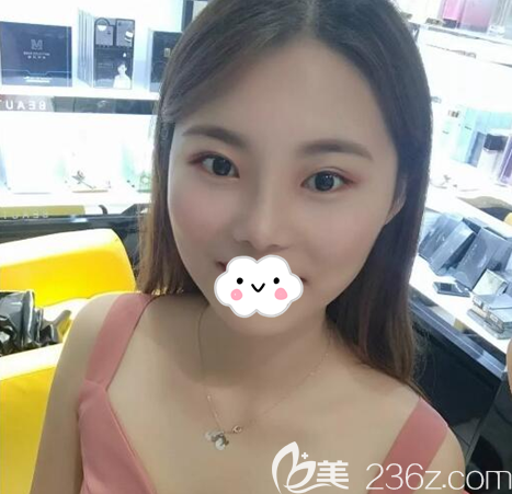 塌鼻子眼無神的我選擇在南充華美名媛做雙眼皮和綜合隆鼻的真實(shí)心理路程和恢復(fù)效果