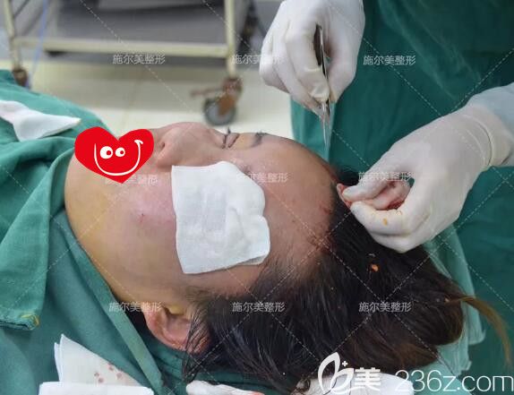 自體脂肪填充豐額頭手術(shù)中