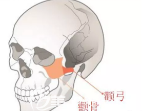 顴骨和顴弓的示意圖