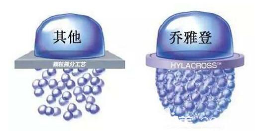 喬雅登玻尿酸分子量比較大，比較硬以及粘彈性比較高