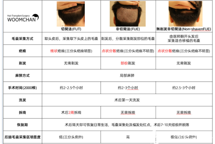 【韓國永長植發(fā)醫(yī)院】切開法(FUT) & 非切開法 (FUE) & 無削發(fā)非切開法 (Non-shavenFUE)