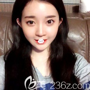 不知鄭裕錫在韓國(guó)什么醫(yī)院我告訴你,去韓國(guó)德萊茵顴骨內(nèi)推手術(shù)+隆鼻失敗修復(fù)是鄭院做的