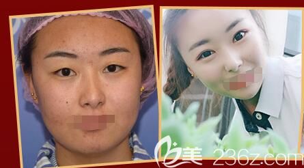 <!--<i data=20240703-sp></i>-->院長眼綜合案例對比