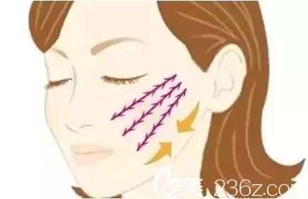 面部線雕之后會導(dǎo)致面部變得僵硬嗎？