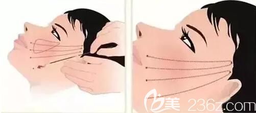 面部線雕的過程示意圖