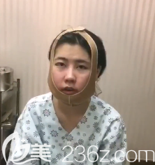 術后第1天 術后第1天