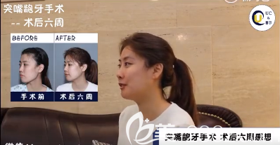 首爾UC牙科牙齒矯正怎么樣 首爾UC牙科牙齒矯正怎么樣