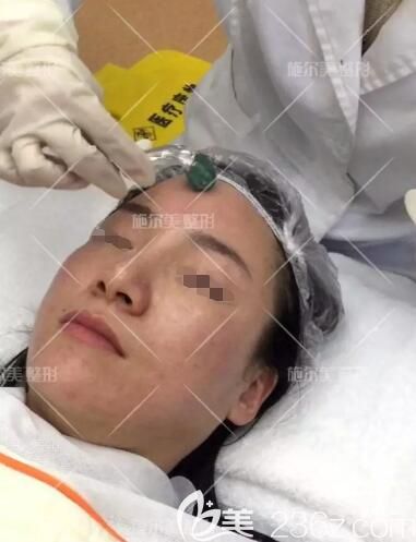 常州施爾美醫(yī)生做微針美塑過(guò)程中